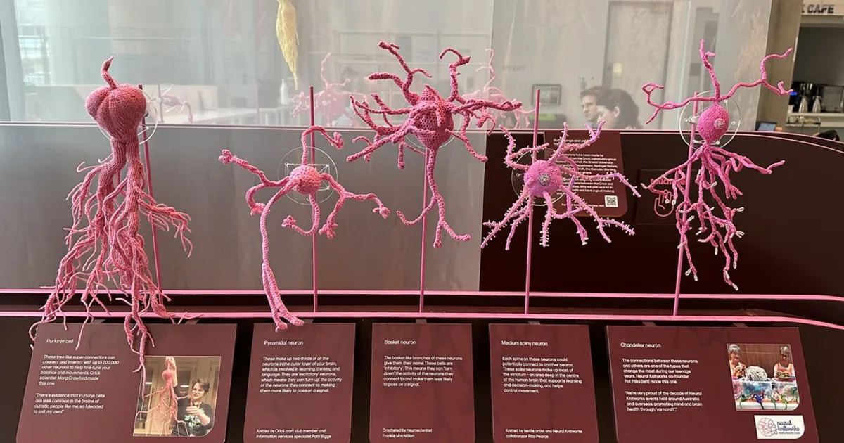 A model of connected brain cells.